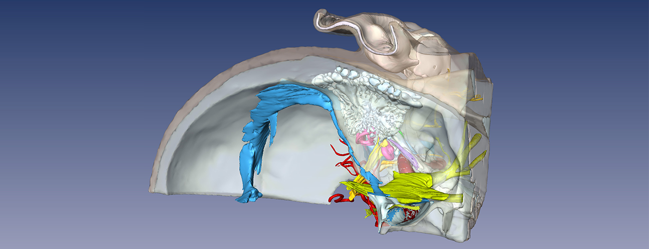 digital image of 3D temporal bone